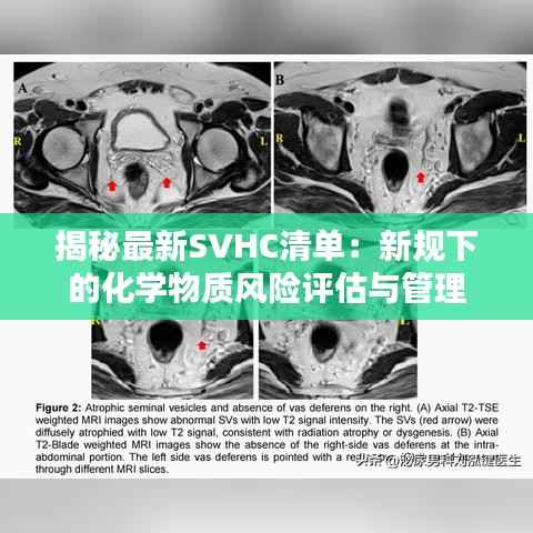 揭秘最新SVHC清单:新规下的化学物质风险评估与管理
