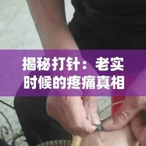 揭秘打针:老实时候的疼痛真相